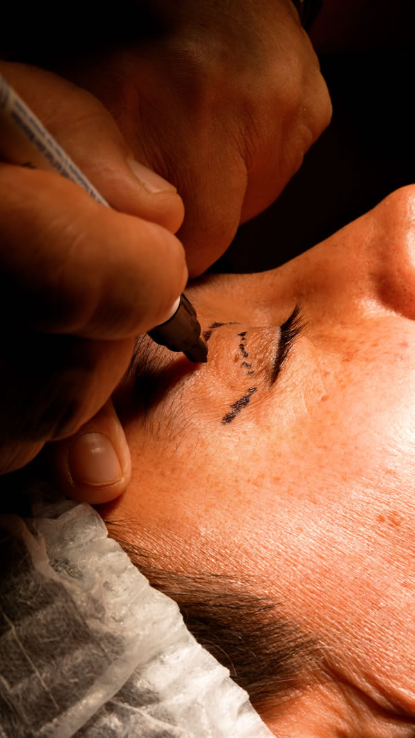 cirugia plastica facial