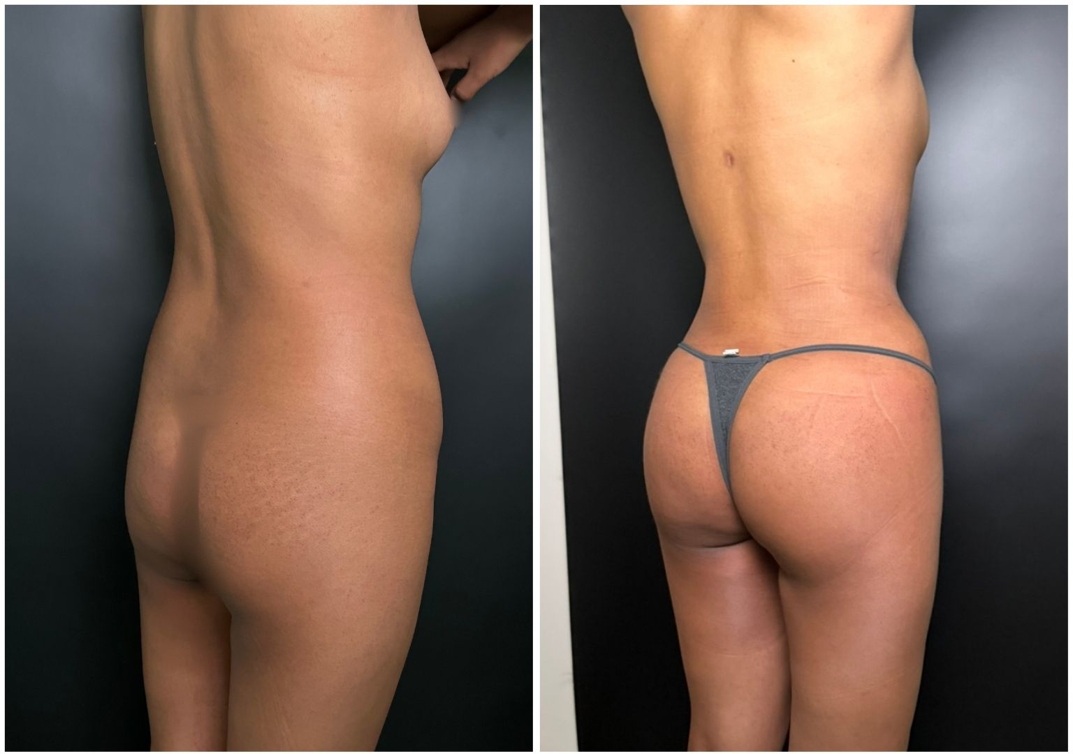 Cirugia Plastica Corporal