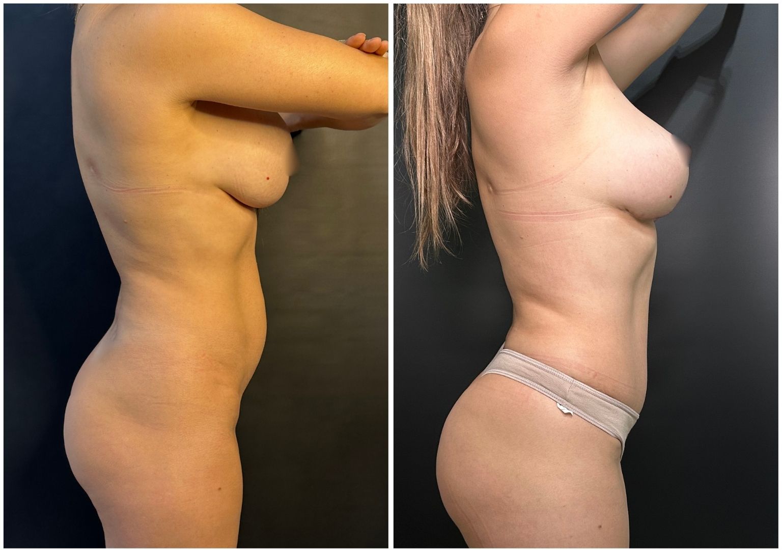 Cirugia Plastica Corporal